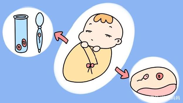 试管婴儿
