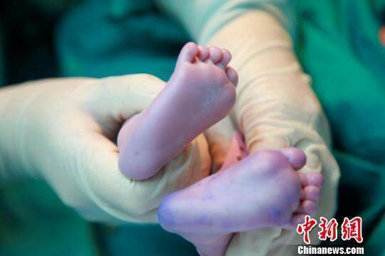 试管婴儿