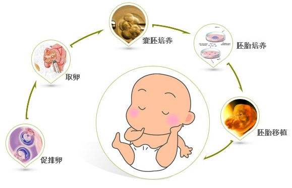 辅助生殖技术