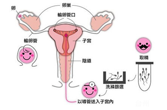 不孕不育