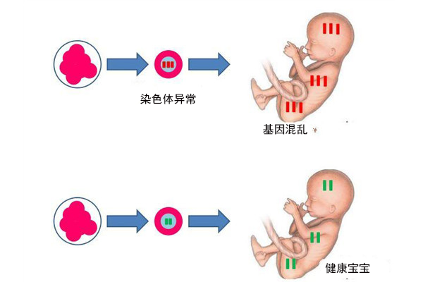 试管婴儿