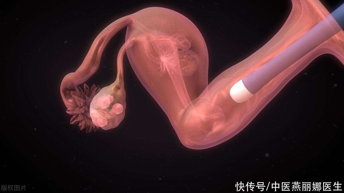 东莞捐卵补偿