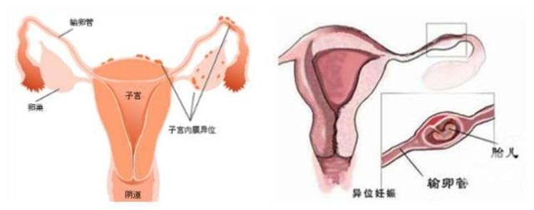 举报捐卵电话