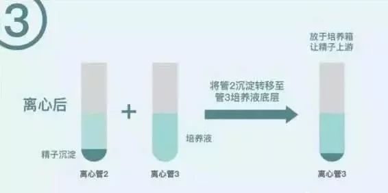 东营捐卵机构