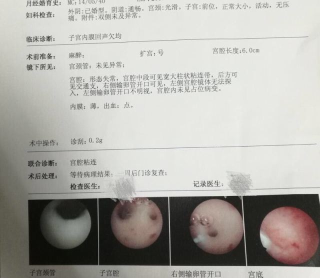 东莞供卵代怀