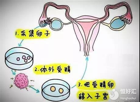 东莞招聘捐卵女孩机构